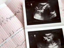 A Georgia woman gave birth to a 1-pound, 16-ounce baby boy on June 13, 2025, after four months on life support.